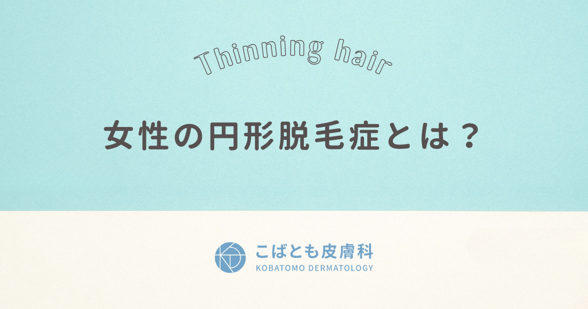 女性の円形脱毛症とは？