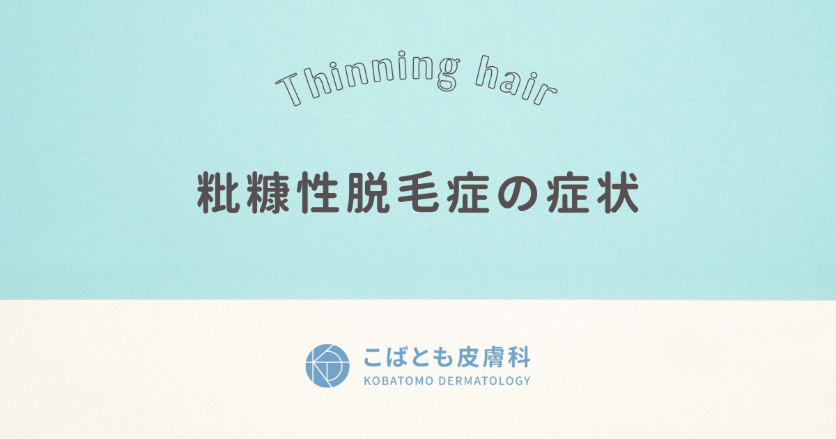 粃糠性脱毛症(ひこうせいだつもうしょう) の症状