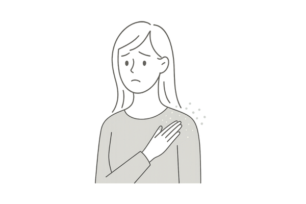 大量のフケが肩に落ちて困っている女性