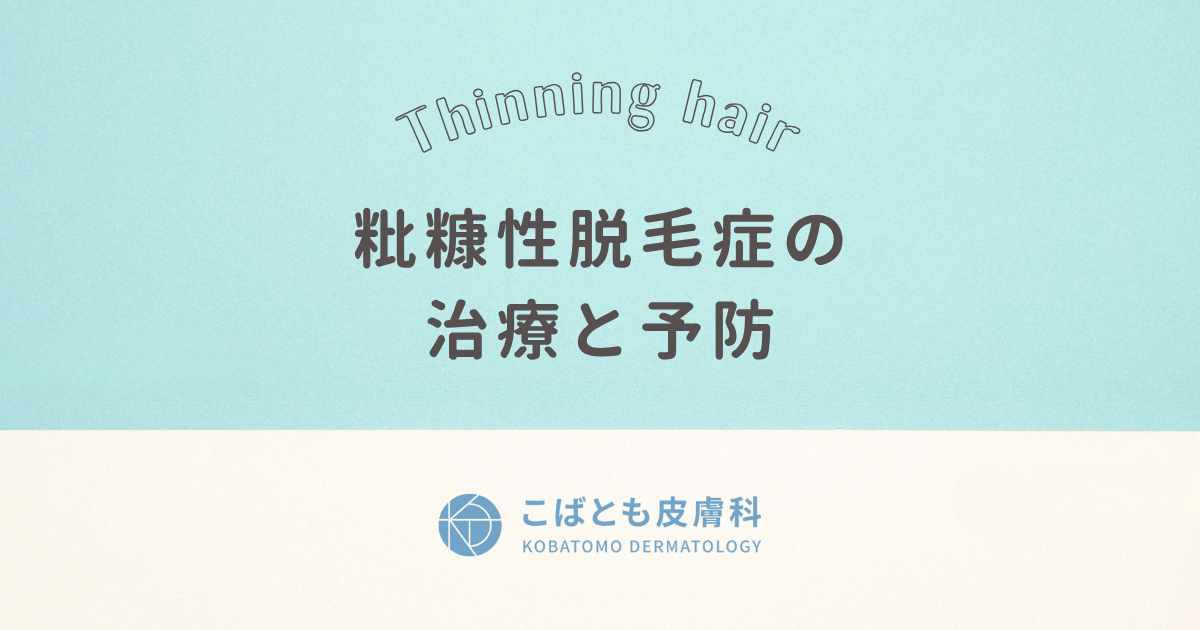 粃糠性脱毛症(ひこうせいだつもうしょう) の治療と予防