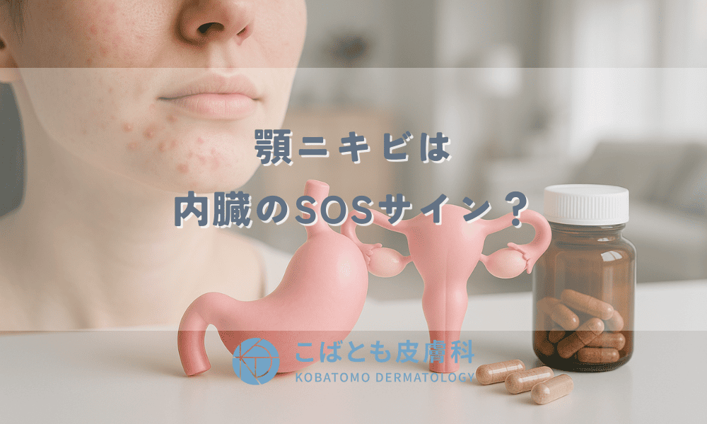 顎ニキビは内臓のSOSサイン？胃腸・婦人科系との関係と体の中から治す方法