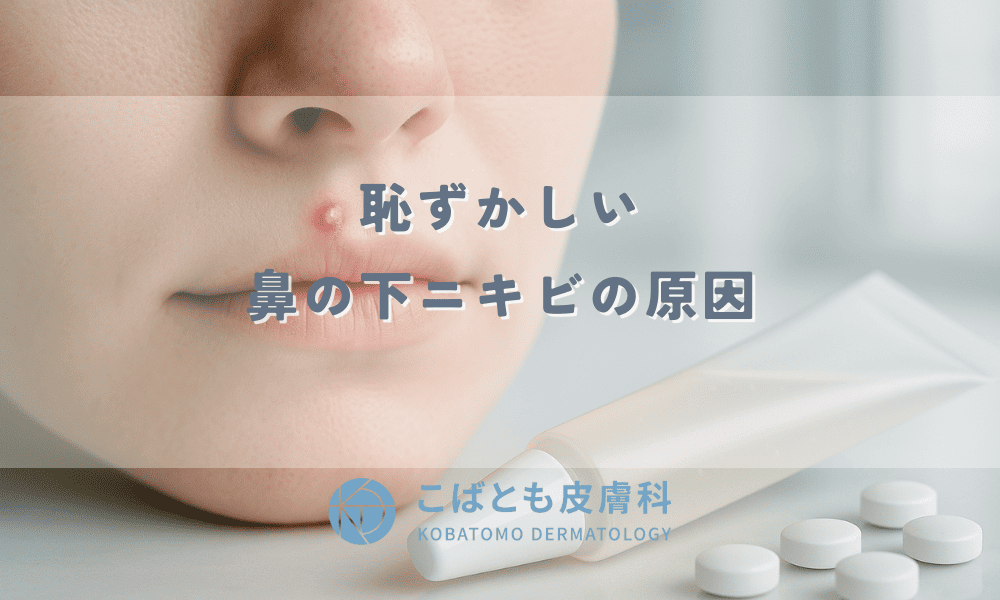 【目立つ人中ニキビ】恥ずかしい鼻の下ニキビの原因と跡を残さず早く治す5つの対策