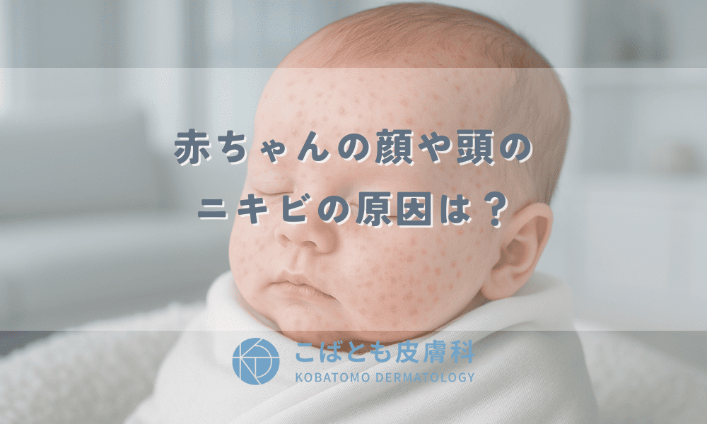 赤ちゃんの顔や頭のニキビの原因は？新生児ニキビと乳児湿疹の見分け方・正しいケア方法