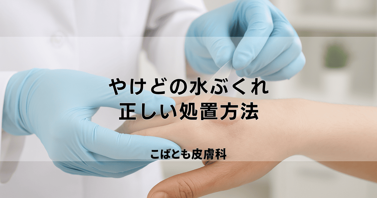 やけどの水ぶくれは潰すべき？正しい処置と早くきれいに治すためのケア方法