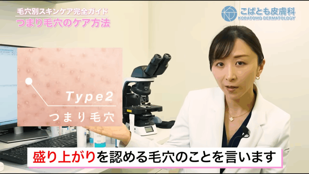 詰まり毛穴