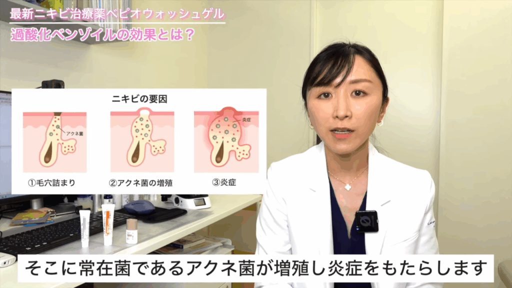 ニキビの要因