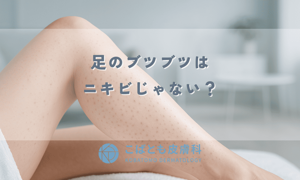 足のブツブツはニキビじゃない？毛嚢炎との違いと原因別の治し方｜ムレ・自己処理の対策も