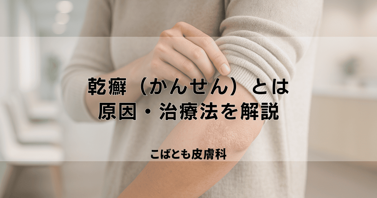 乾癬（かんせん）とはどんな病気？原因・うつらないこと・治療法を解説