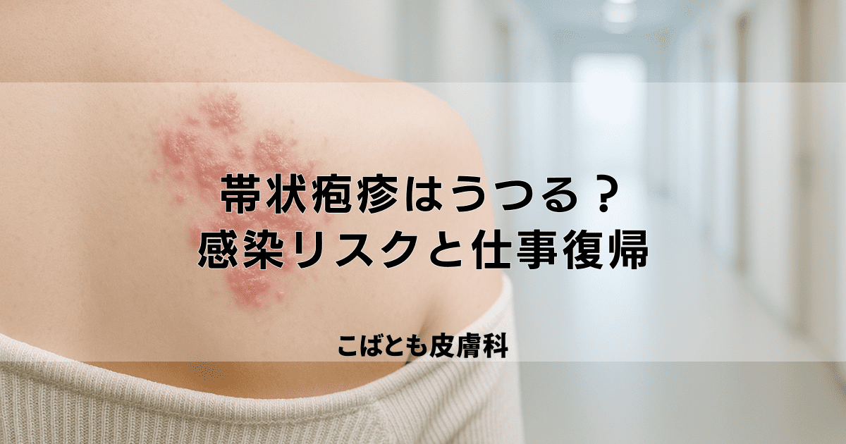 帯状疱疹は大人にうつる？周りの人への感染リスクと仕事復帰の目安