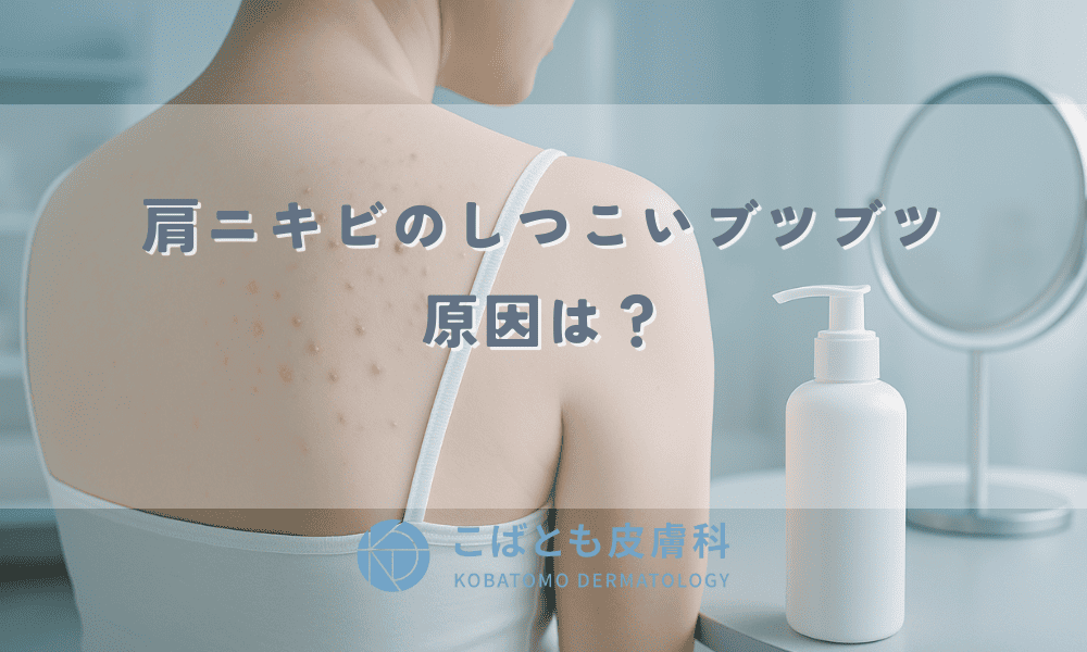 肩ニキビのしつこいブツブツ、原因は？皮膚科医が教える治し方と跡にしない予防ケア