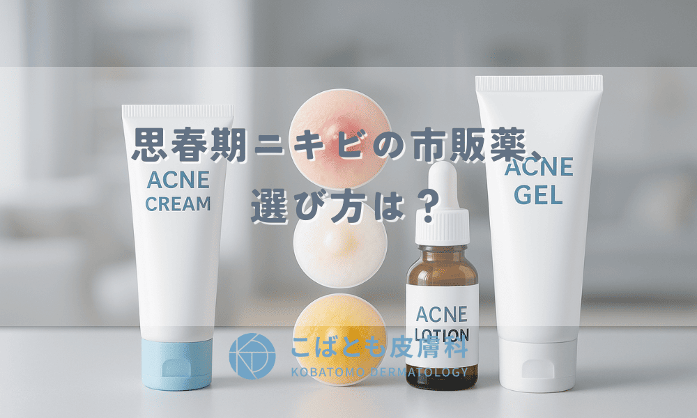 思春期ニキビの市販薬、選び方は？症状別（赤・白・黄）に効く成分と商品を専門家が解説