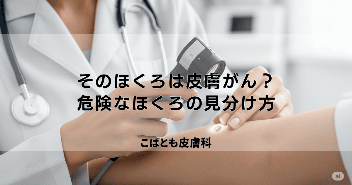 そのほくろ、皮膚がんかも？危険なほくろの5つの見分け方【ABCDEルール】