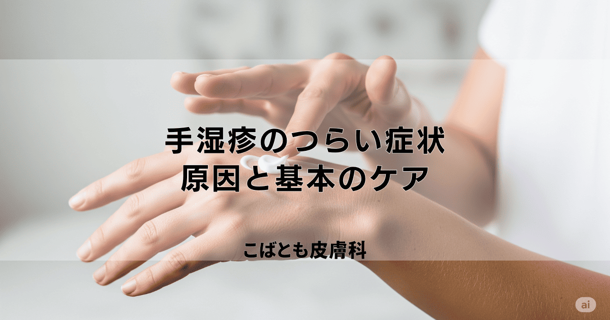 「手湿疹」とは？つらい症状の原因と悪化させないための基本のケア