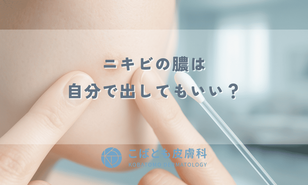 ニキビの膿は自分で出してもいい？安全な対処法と絶対NGな潰し方