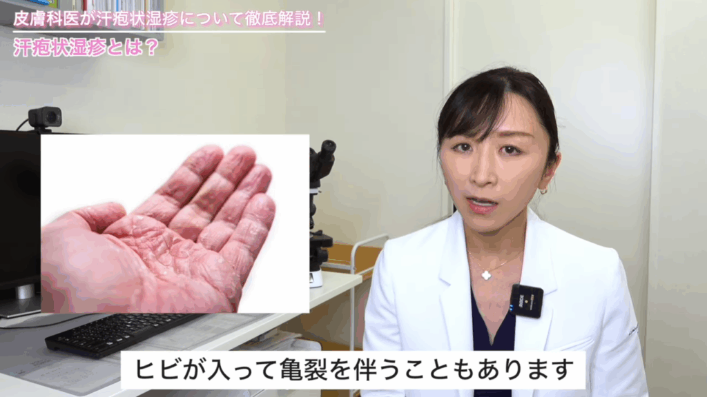 ヒビが入って亀裂を伴うこともあります