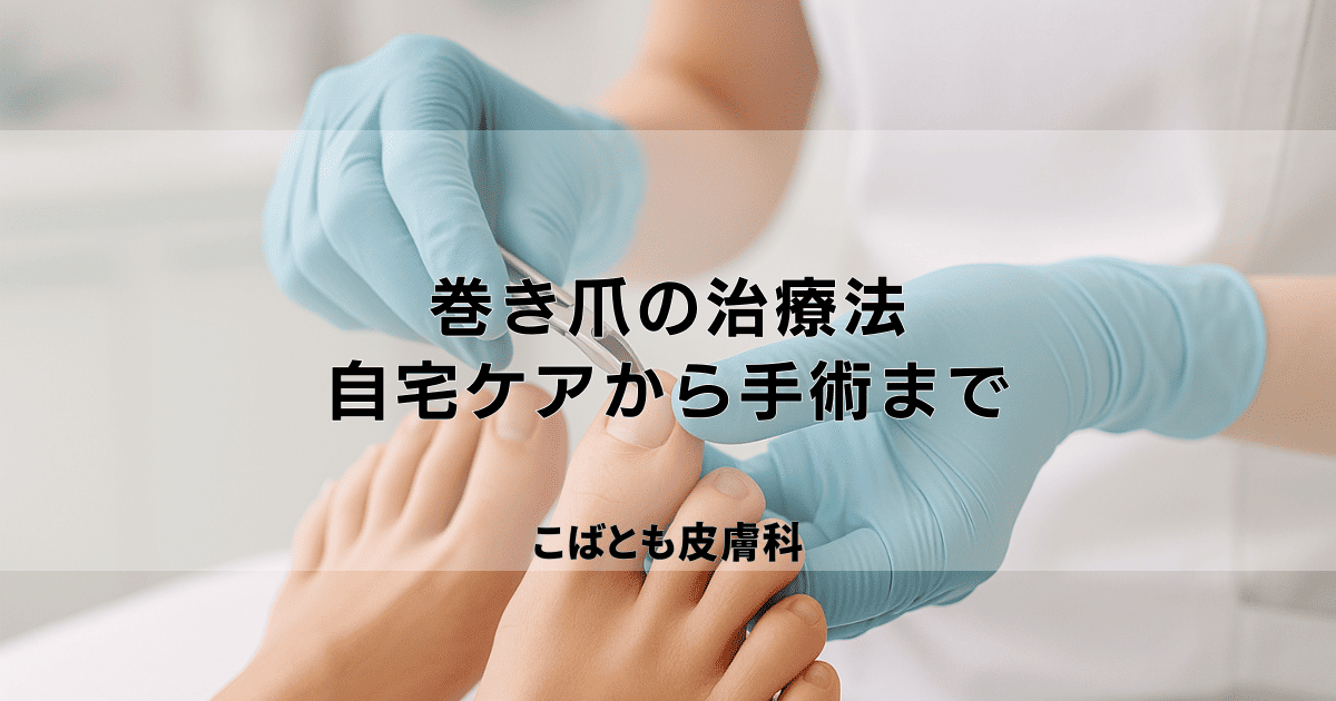 巻き爪の治療法を段階別に解説｜自分でできるケアから病院での手術まで