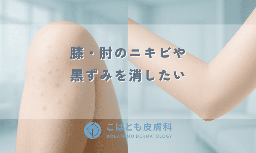 膝・肘のニキビや黒ずみを消したい！ザラザラ・ブツブツの原因とつるつるにする方法