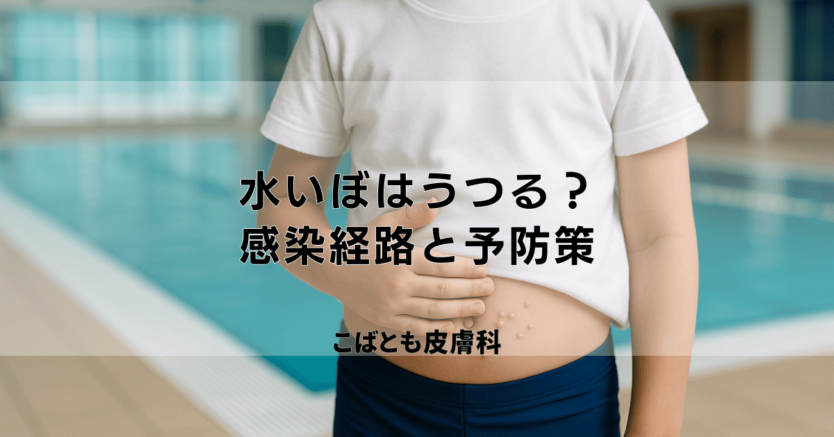 「水いぼ」はうつる？主な感染経路とプールや家庭内での感染予防策