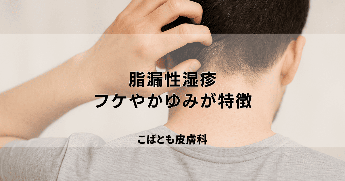 脂漏性湿疹（しろうせいしっしん）とは？フケやかゆみが特徴の皮膚炎を解説