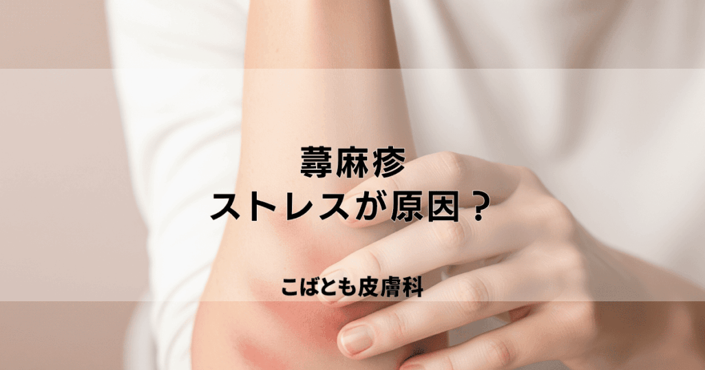 その蕁麻疹、ストレスが原因かも？心と体のサインを読み解く対処法
