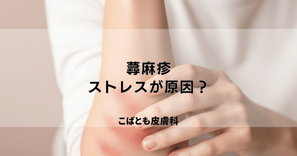 その蕁麻疹、ストレスが原因かも？心と体のサインを読み解く対処法