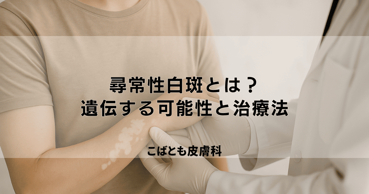 肌の色が抜ける「尋常性白斑」とは？遺伝する可能性と皮膚科での治療法