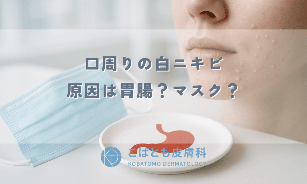 口周りの白ニキビ、原因は胃腸？マスク？皮膚科医が教える正しい治し方と予防法