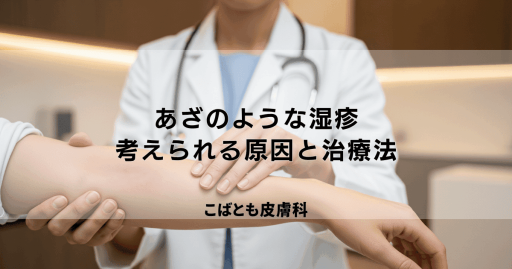 その「あざのような湿疹」の正体は？考えられる原因と皮膚科での治療法を解説