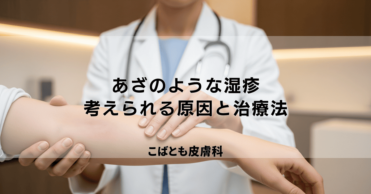 その「あざのような湿疹」の正体は？考えられる原因と皮膚科での治療法を解説