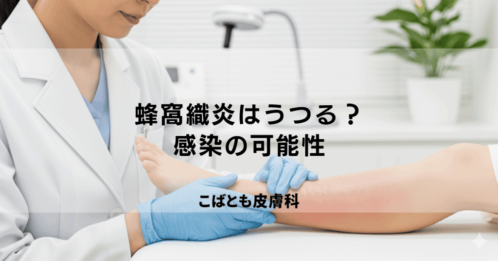 蜂窩織炎（ほうかしきえん）は他の人にうつる？感染の可能性と正しい知識