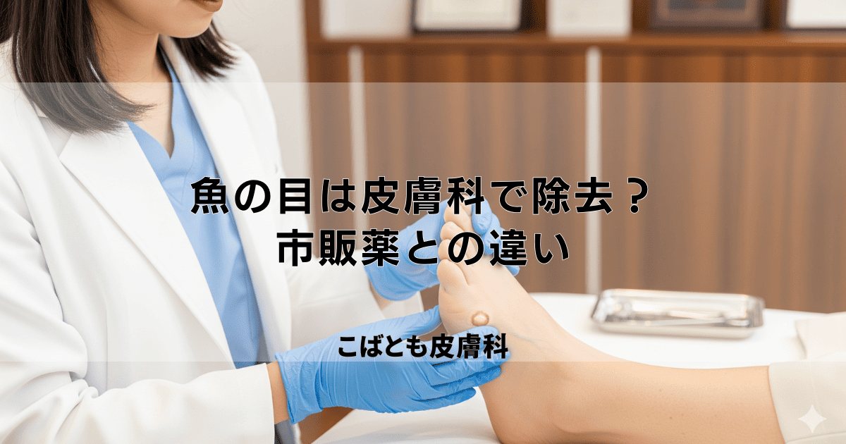 痛い「魚の目」は皮膚科で除去すべき？市販薬との違いと病院での治療法