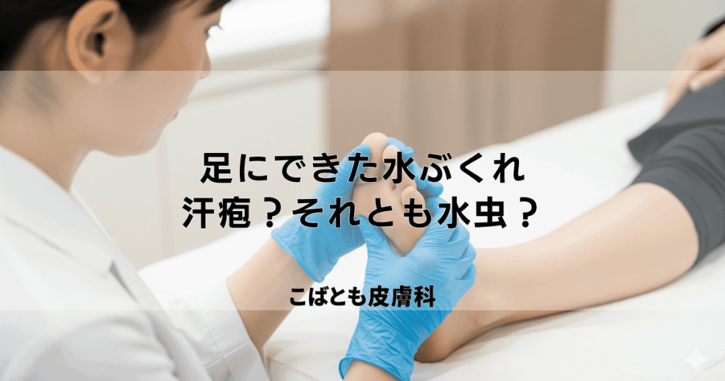 足にできた水ぶくれ、汗疱？それとも水虫？症状から見分けるポイント