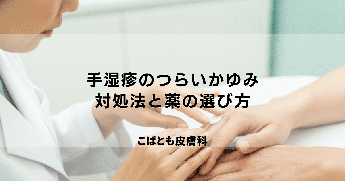 手湿疹のつらいかゆみをどうにかしたい！効果的な対処法と薬の選び方