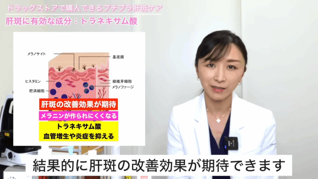 肝斑に有効な成分：トラネキサム酸