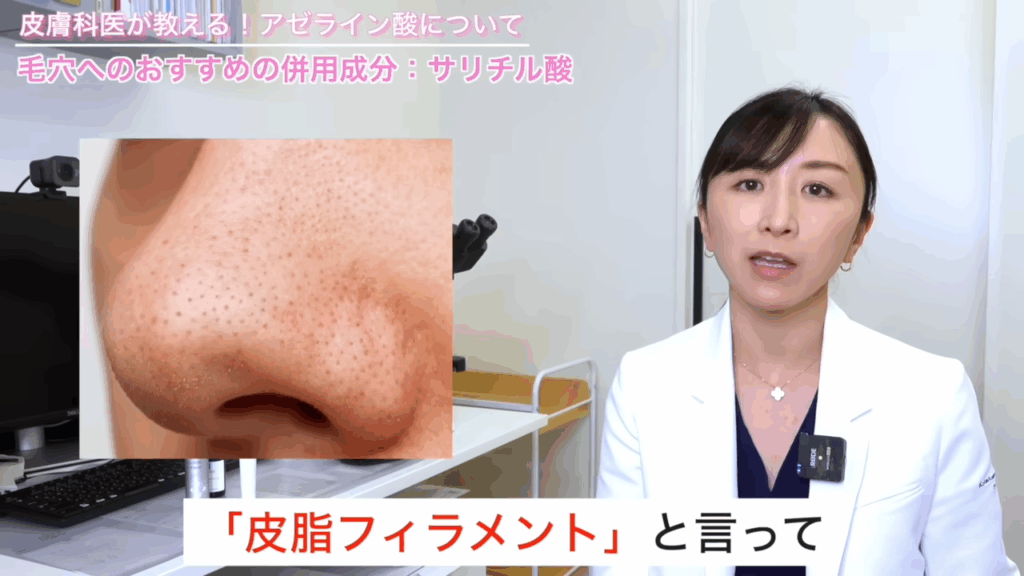 皮脂フィラメント
