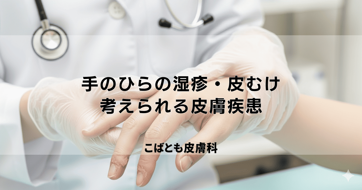手のひらの湿疹・皮むけの原因は？考えられる皮膚疾患と効果的なケア