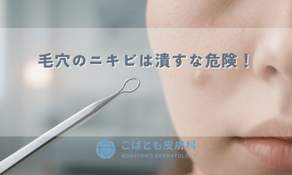 毛穴のニキビは潰すな危険！角栓を取り除き、くり返さない肌を作るための知識