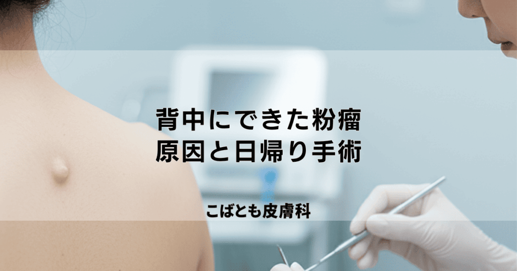 背中にできた「しこり」は粉瘤（ふんりゅう）？原因と日帰り手術について