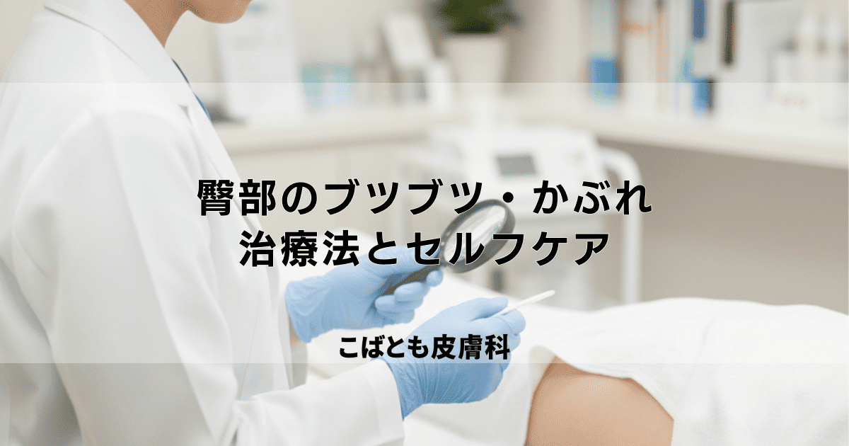 おしりのブツブツ・かぶれの原因は？皮膚科での治療法とセルフケアでできること