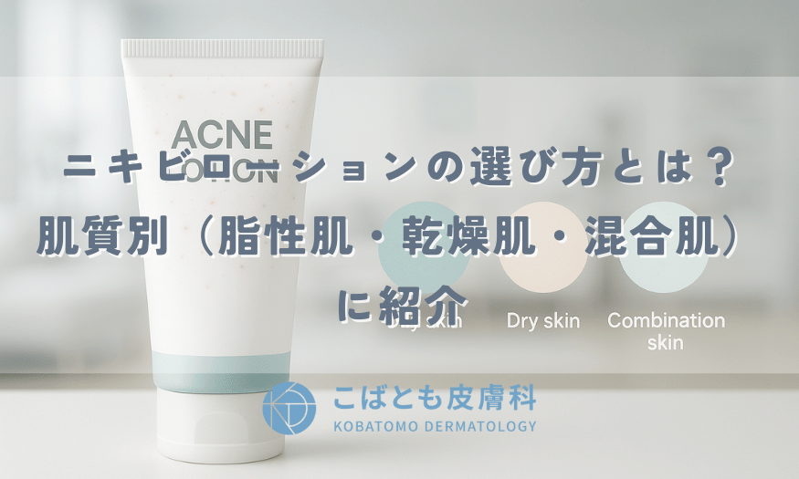 ニキビローションの選び方とは？肌質別（脂性肌・乾燥肌・混合肌）に紹介