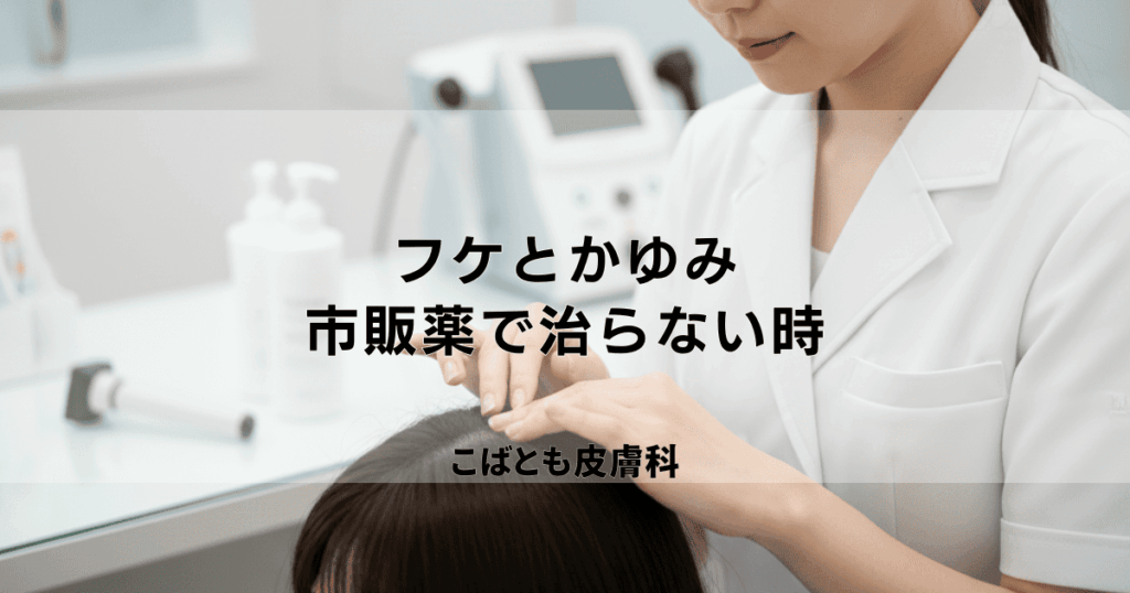 フケとかゆみが市販薬で治らない…皮膚科へ行く目安と病院での治療法