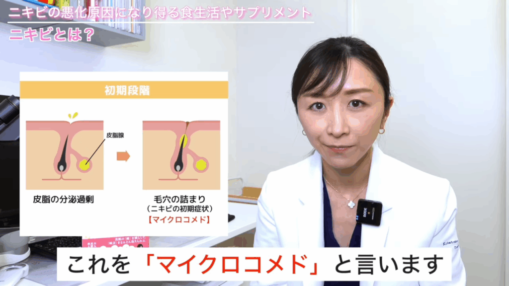 ニキビの初期段階