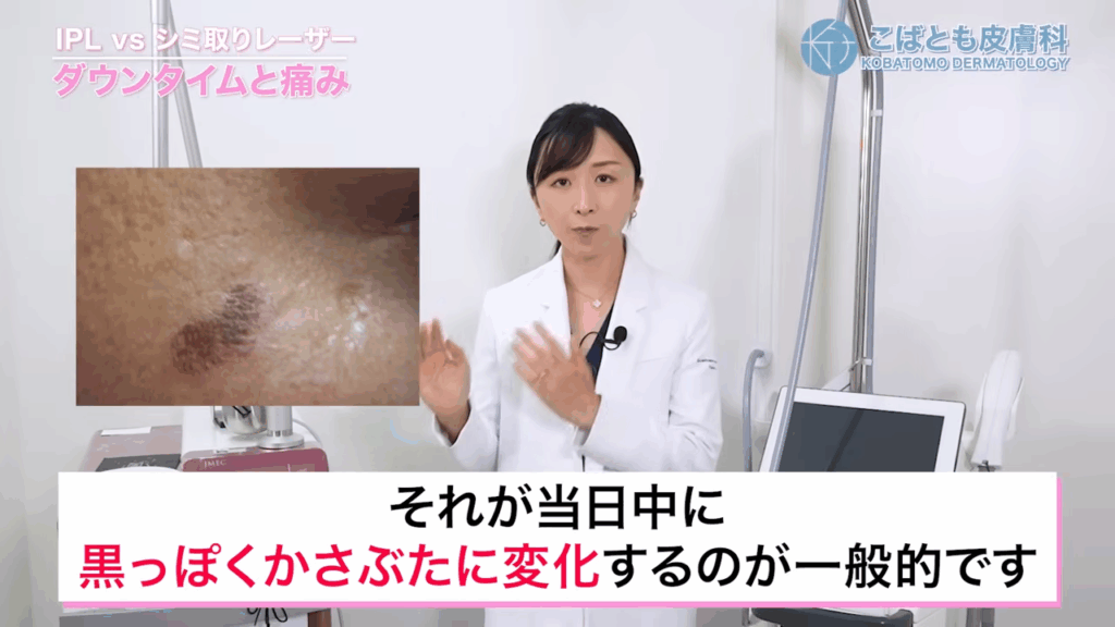 レーザー照射後は