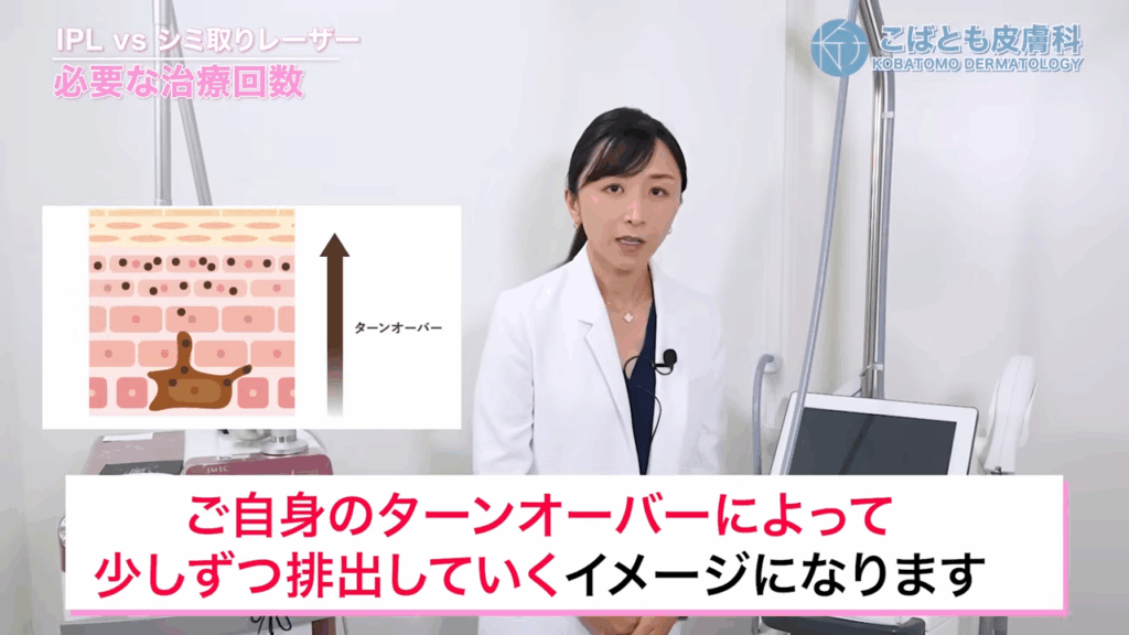 IPLの場合、照射によってメラニンにダメージを与えてそれをご自身のターンオーバーによって少しずつ排出していく