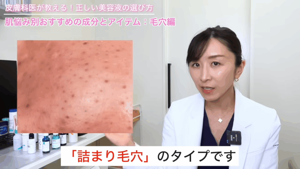 詰まり毛穴