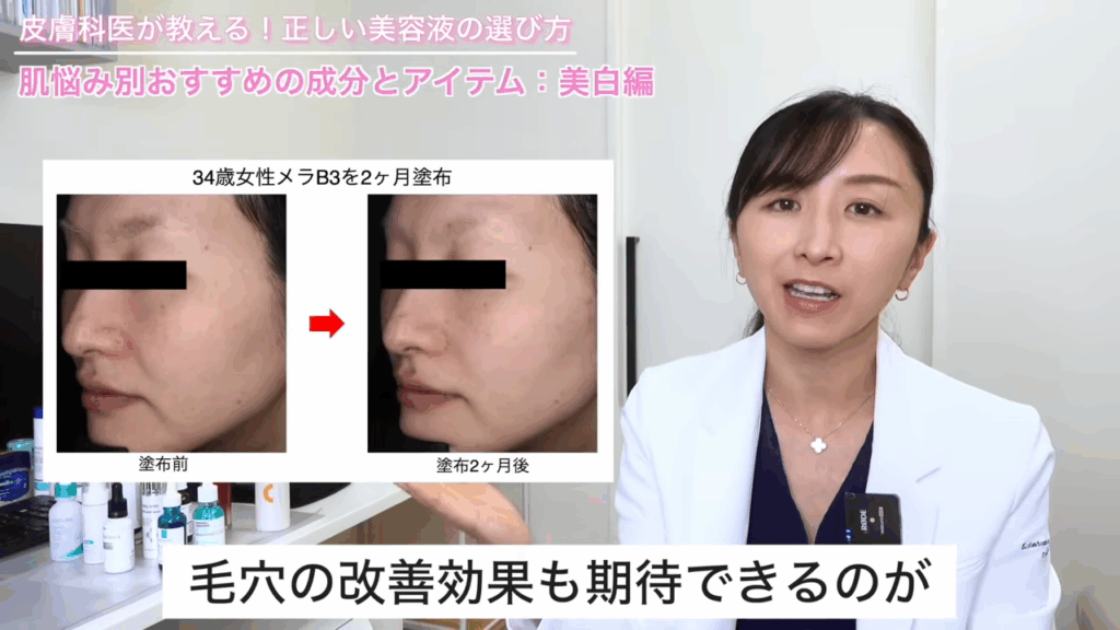 34歳女性メラB3を2ヶ月塗布