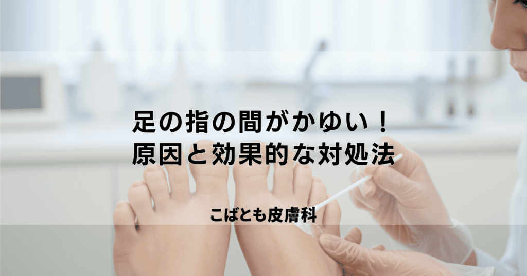 足の指の間がかゆい！でも水虫じゃない…考えられる原因と効果的な対処法
