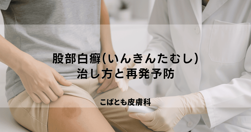 股部白癬(こぶはくせん)「いんきんたむし」の正しい治し方と再発予防策