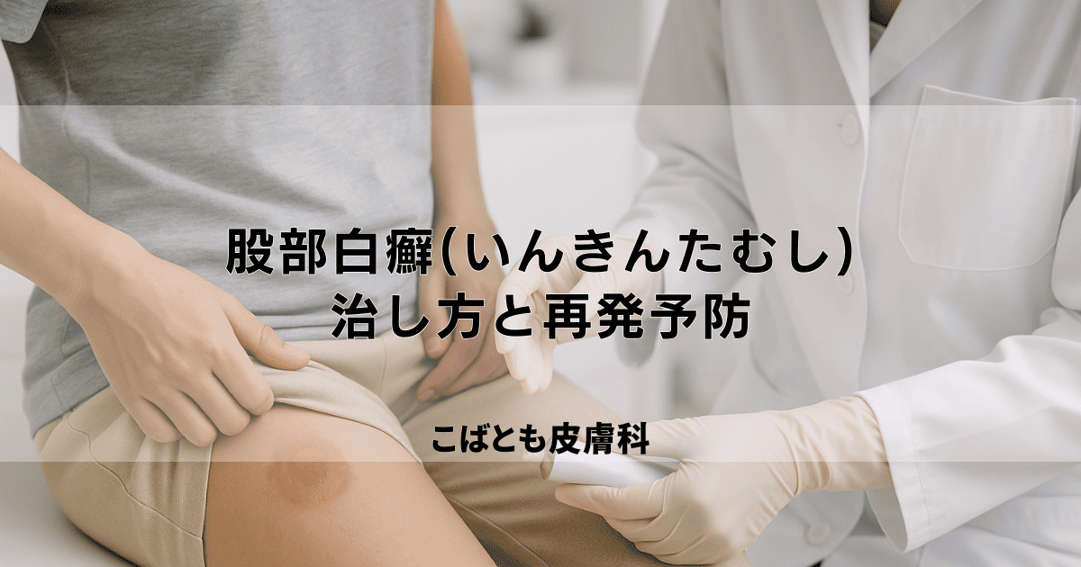 股部白癬(こぶはくせん)「いんきんたむし」の正しい治し方と再発予防策