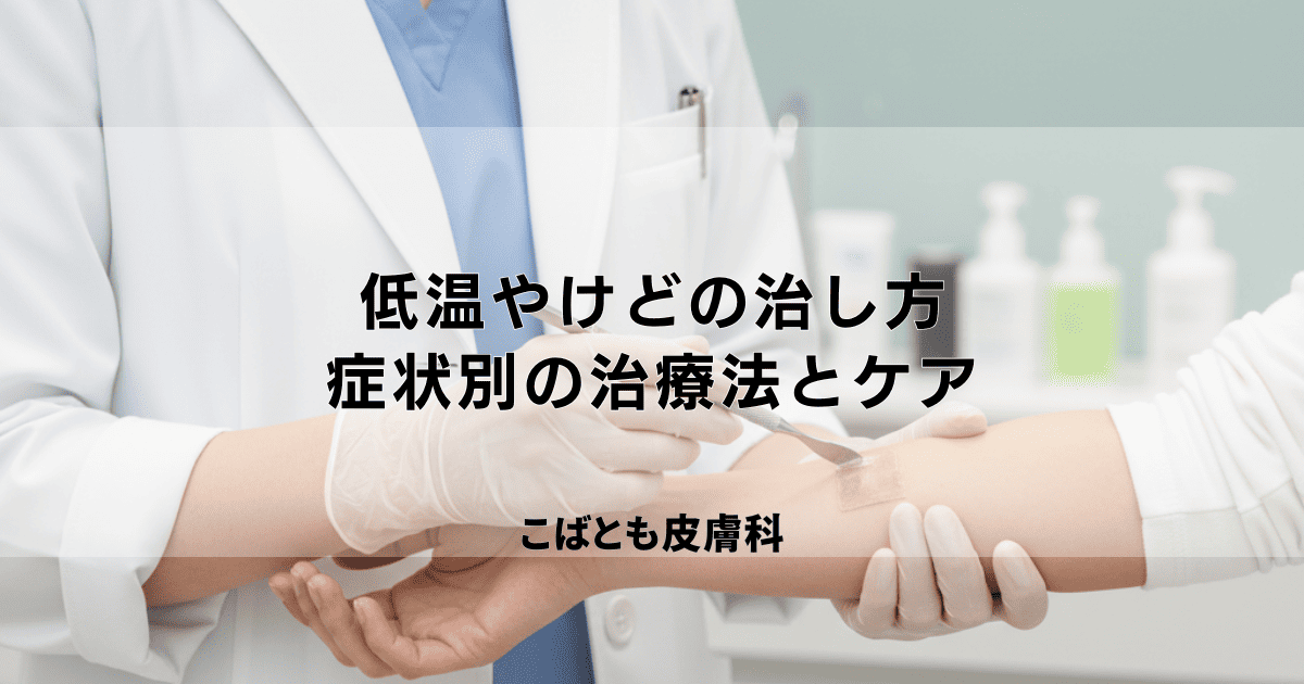【低温やけどの治し方】軽症から重症まで、症状別の正しい治療法とケア